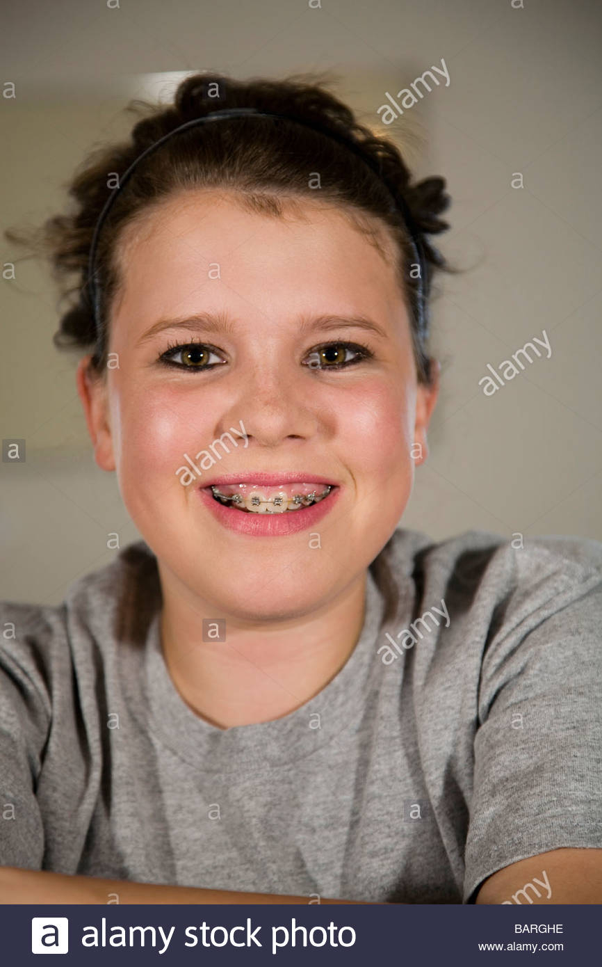 Heavy Eye Makeup A Pretty Teenage Girl With Braces Wearing Heavy Eye Makeup Stock