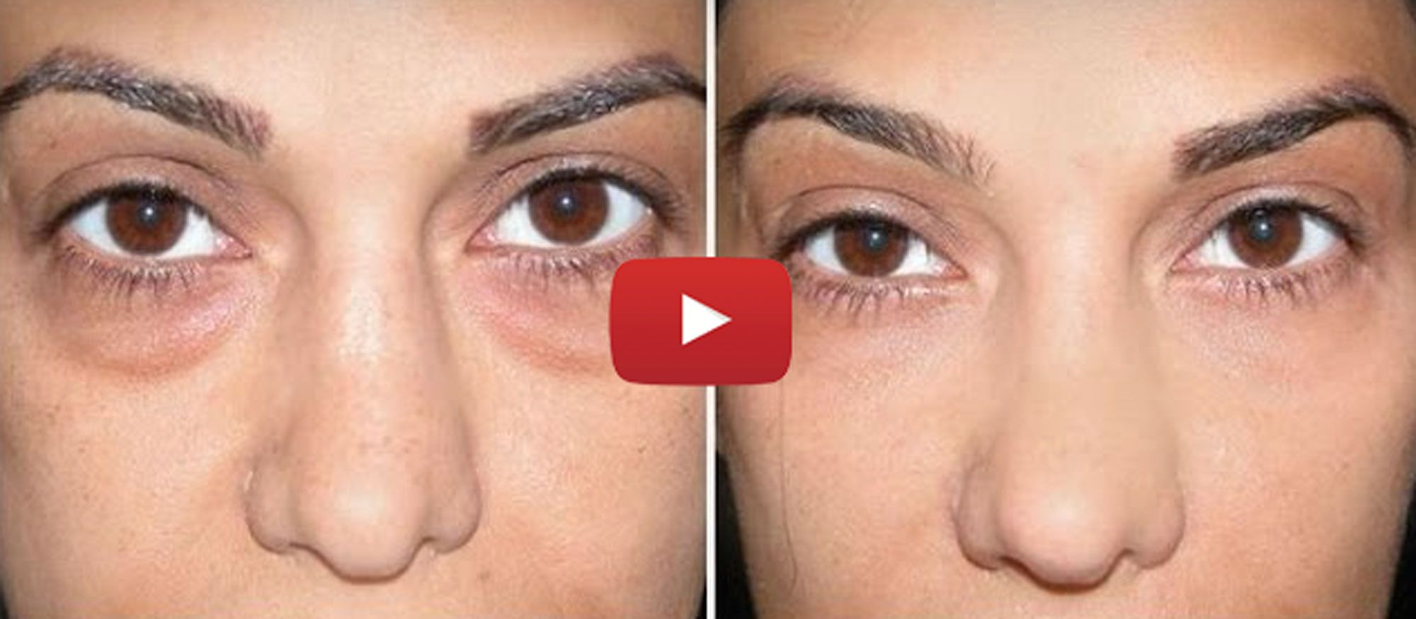 Makeup For Under Eye Bags Actually Using Baking Soda To Get Rid Of Your Undereye Circles Is A