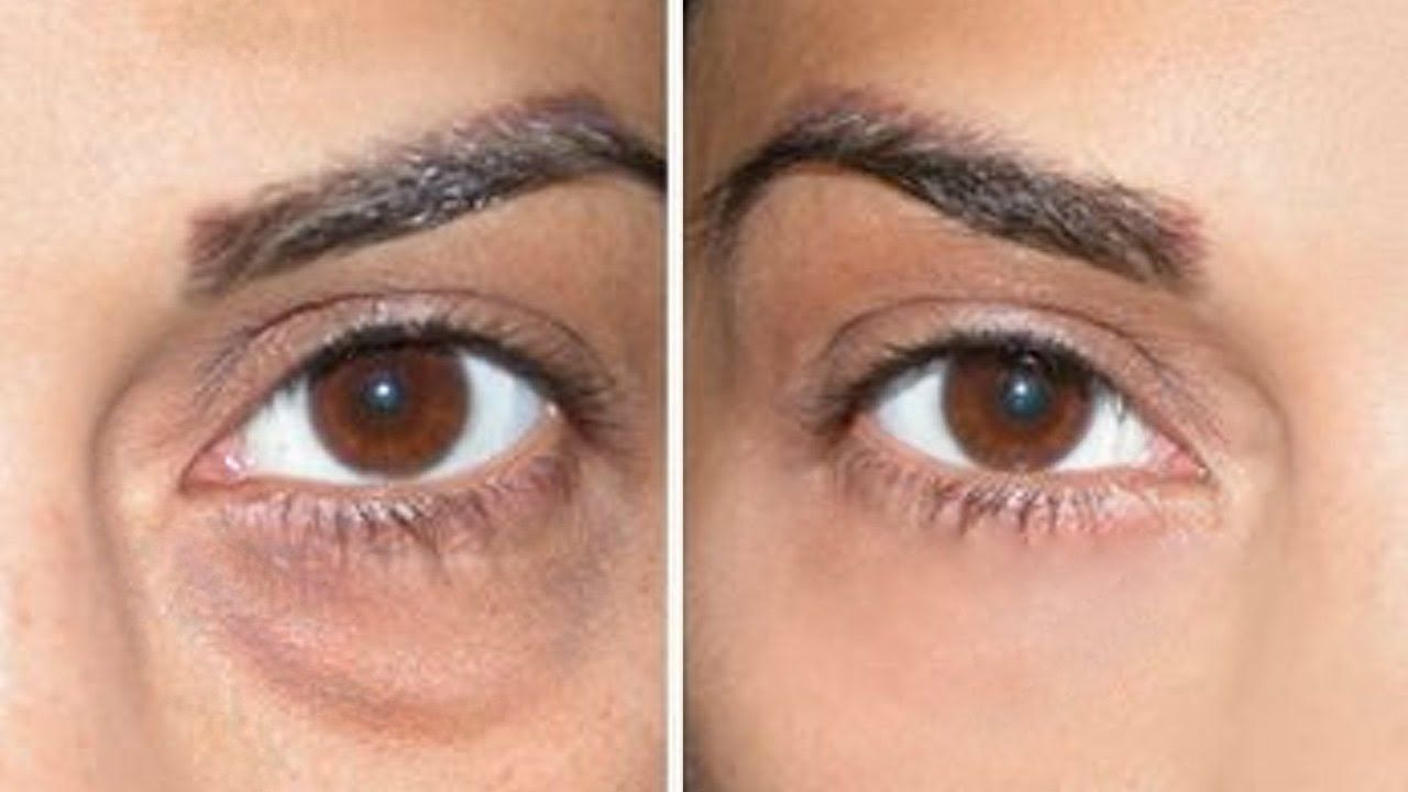 Makeup For Under Eye Bags